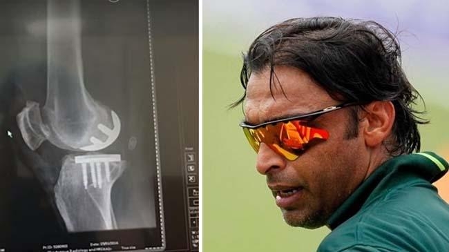 shoaib akhtar and his knee