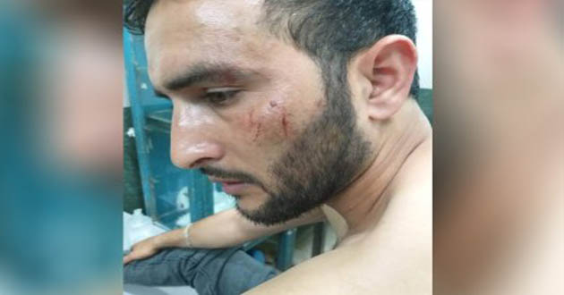 kashmiri attacked in kalkata